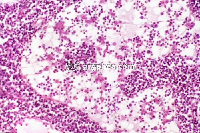 Ganglion lymphatique x100 - gryphea.com